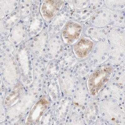 Immunohistochemistry-Paraffin: STAT1 Antibody [NBP1-81578]