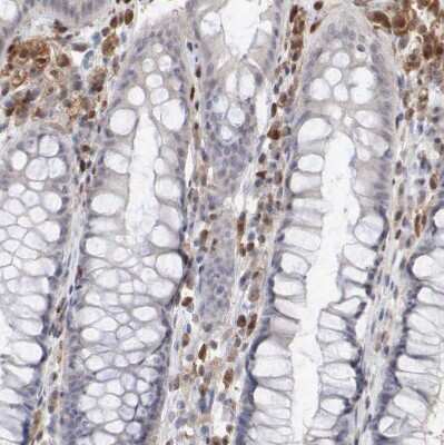 Immunohistochemistry-Paraffin: STAT1 Antibody [NBP1-81578]