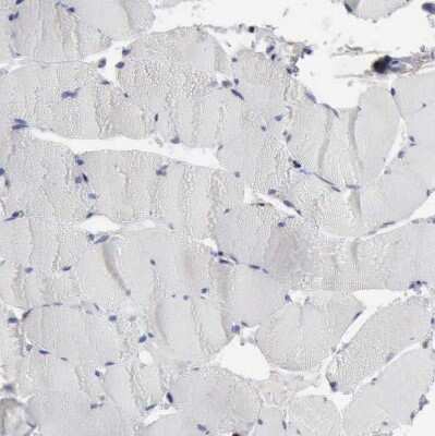 Immunohistochemistry-Paraffin: STAT1 Antibody [NBP1-81578]