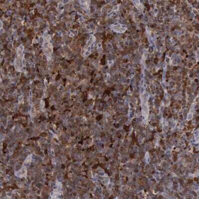 Immunohistochemistry-Paraffin: STAT1 Antibody [NBP1-81579]