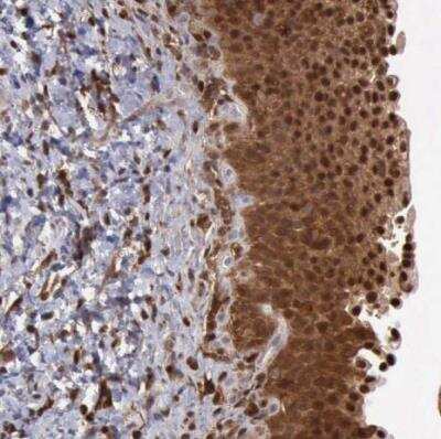 Immunohistochemistry-Paraffin: STAT1 Antibody [NBP1-81579]