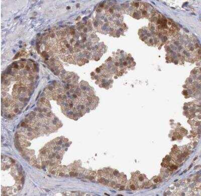 Immunohistochemistry-Paraffin: STAT1 Antibody [NBP1-81579]