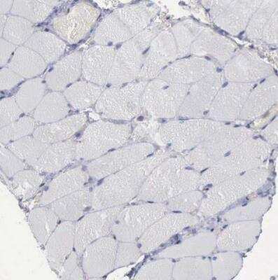 Immunohistochemistry-Paraffin: STAT1 Antibody [NBP1-81579]