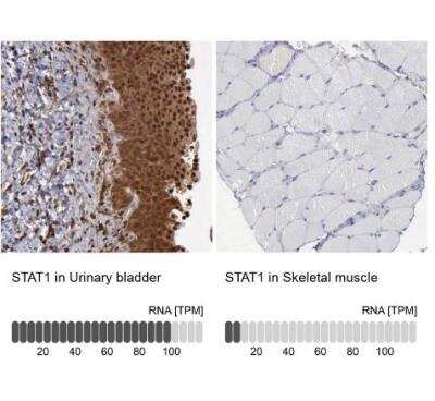 Immunohistochemistry-Paraffin: STAT1 Antibody [NBP1-81579]