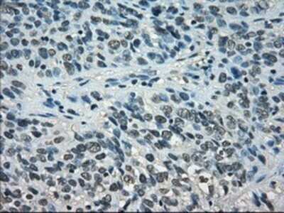 Immunohistochemistry: STAT1 Antibody (OTI15H3) - Azide and BSA Free [NBP2-74377]