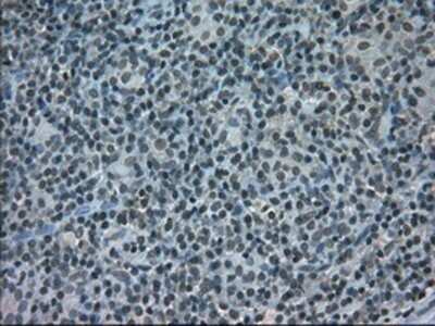 Immunohistochemistry: STAT1 Antibody (OTI15H3) - Azide and BSA Free [NBP2-74377]