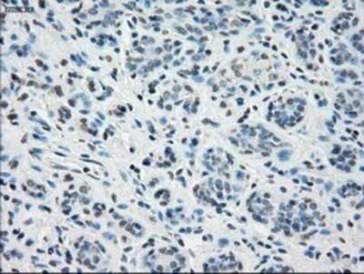 Immunohistochemistry: STAT1 Antibody (OTI4H9) - Azide and BSA Free [NBP2-74375]