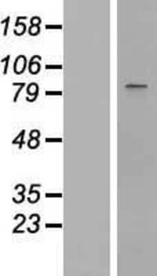 Western Blot: STAT1 Overexpression Lysate [NBP2-09841]