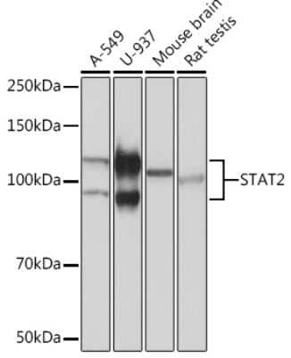 Western Blot: STAT2 Antibody (4A5P8) [NBP3-16228]