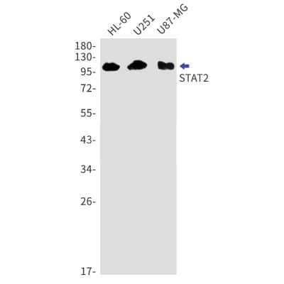 Western Blot: STAT2 Antibody (S01-2F6) [NBP3-20074]