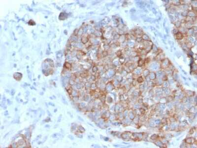 Immunohistochemistry-Paraffin: STAT2 Antibody (STAT2/2650) - Azide and BSA Free [NBP3-08587]