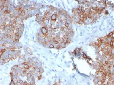 Immunohistochemistry-Paraffin: STAT2 Antibody (STAT2/2650) [NBP3-07617]