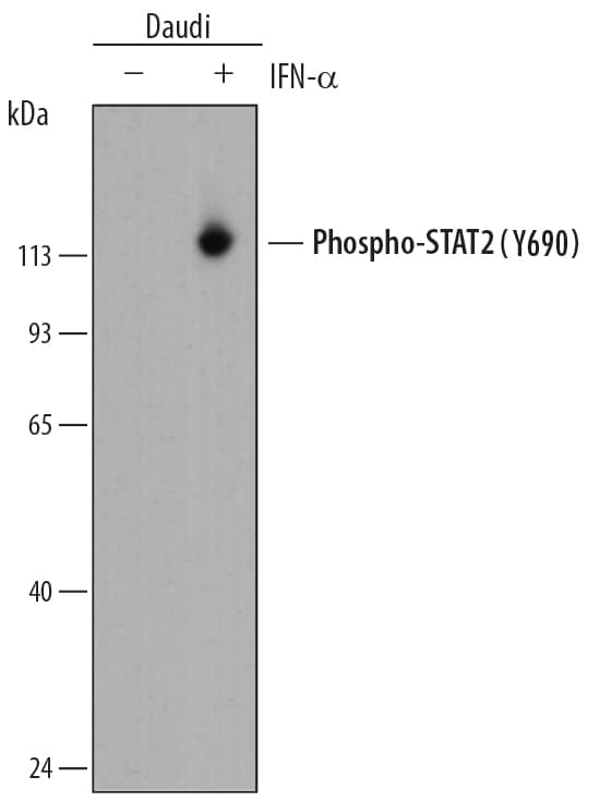 Detection of Human Phospho-STAT2 (Y689) antibody by Western Blot.