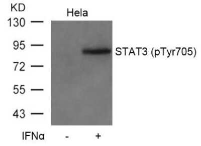 Western Blot: STAT3 [p Tyr705] Antibody [NB100-82213]