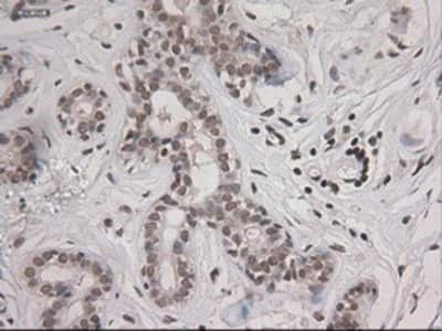 Immunohistochemistry-Paraffin: STAT3 Antibody (OTI21E7) [NBP1-48014]