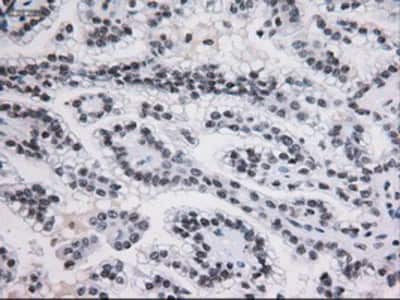 Immunohistochemistry-Paraffin: STAT3 Antibody (OTI21E7) [NBP1-48014]