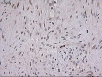 Immunohistochemistry-Paraffin: STAT3 Antibody (OTI21E7) [NBP1-48014]