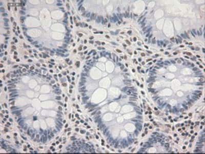 Immunohistochemistry-Paraffin: STAT3 Antibody (OTI21E7) [NBP1-48014]