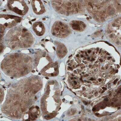 Immunohistochemistry-Paraffin: STAT3 Antibody (CL0490) [NBP2-52935]