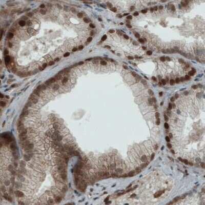 Immunohistochemistry-Paraffin: STAT3 Antibody (CL0490) [NBP2-52935]