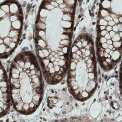 Immunohistochemistry-Paraffin: STAT3 Antibody (CL0490) [NBP2-52935]