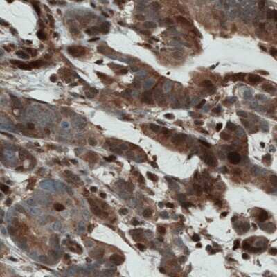 Immunohistochemistry-Paraffin: STAT3 Antibody (CL0490) [NBP2-52935]