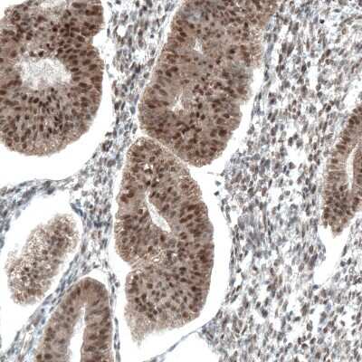 Immunohistochemistry-Paraffin: STAT3 Antibody (CL0492) [NBP2-52936]