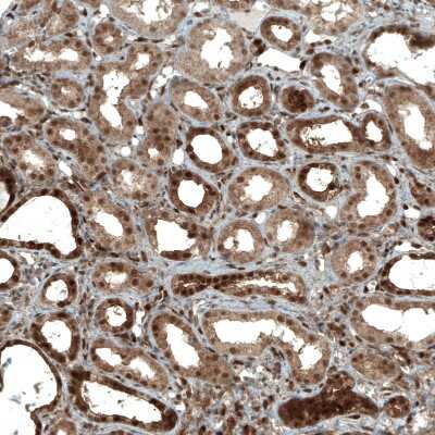 Immunohistochemistry-Paraffin: STAT3 Antibody (CL0492) [NBP2-52936]