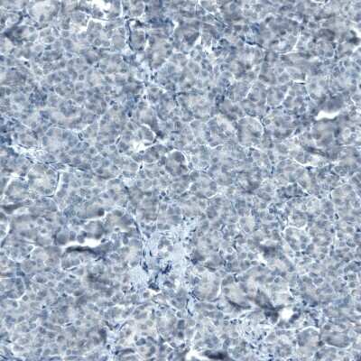 Immunohistochemistry-Paraffin: STAT3 Antibody (CL0492) [NBP2-52936]