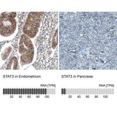 Immunohistochemistry-Paraffin: STAT3 Antibody (CL0492) [NBP2-52936]