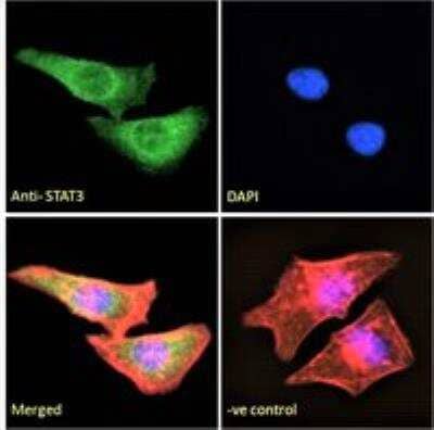 Immunocytochemistry/ Immunofluorescence: STAT3 Antibody [NB100-799]