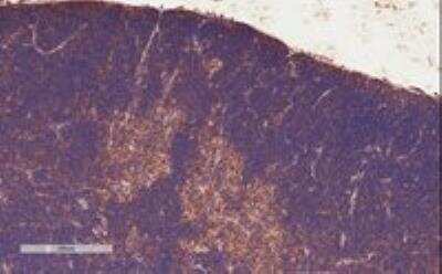 Immunohistochemistry-Paraffin: STAT3 Antibody [NB100-799]