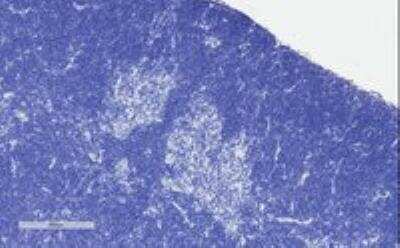 Immunohistochemistry-Paraffin: STAT3 Antibody [NB100-799]