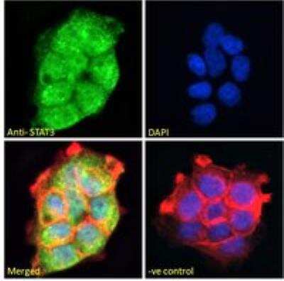 Immunohistochemistry-Paraffin: STAT3 Antibody [NB100-799]