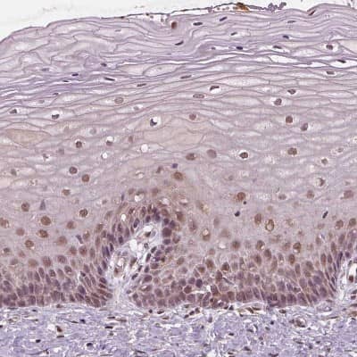 Immunohistochemistry-Paraffin: STAT3 Antibody [NBP2-38857]