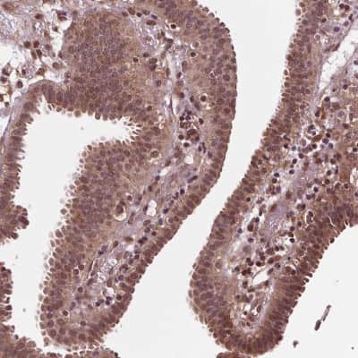 Immunohistochemistry-Paraffin: STAT3 Antibody [NBP2-38857]