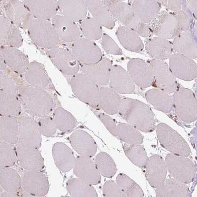 Immunohistochemistry-Paraffin: STAT3 Antibody [NBP2-38857]