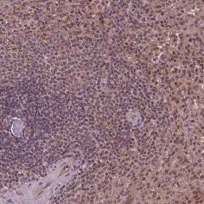 Immunohistochemistry-Paraffin: STAT3 Antibody [NBP2-38857]