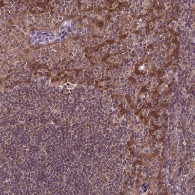 Immunohistochemistry-Paraffin: STAT3 Antibody [NBP2-38857]