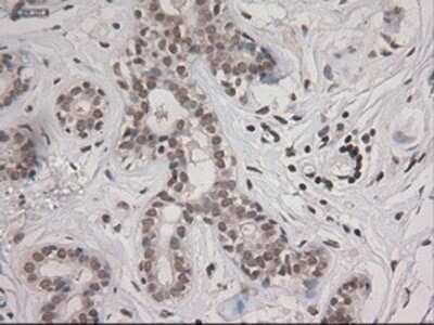 Immunohistochemistry: STAT3 Antibody (OTI21E7) - Azide and BSA Free [NBP2-74378]