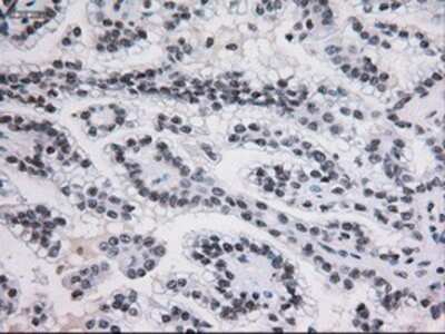 Immunohistochemistry: STAT3 Antibody (OTI21E7) - Azide and BSA Free [NBP2-74378]