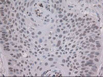 Immunohistochemistry: STAT3 Antibody (OTI21E7) - Azide and BSA Free [NBP2-74378]