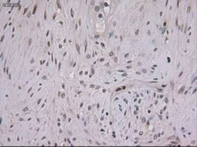 Immunohistochemistry: STAT3 Antibody (OTI21E7) - Azide and BSA Free [NBP2-74378]