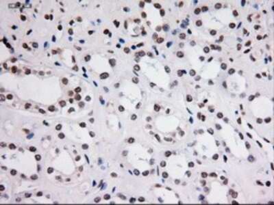 Immunohistochemistry: STAT3 Antibody (OTI21E7) - Azide and BSA Free [NBP2-74378]
