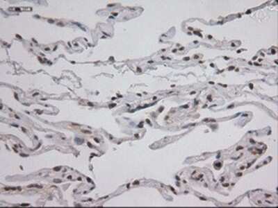 Immunohistochemistry: STAT3 Antibody (OTI21E7) - Azide and BSA Free [NBP2-74378]