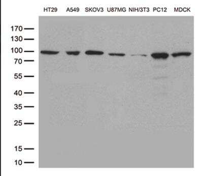 Western Blot: STAT3 Antibody (OTI21E7) [NBP1-48014]
