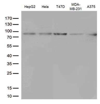 Western Blot: STAT3 Antibody (OTI21E7) [NBP1-48014]