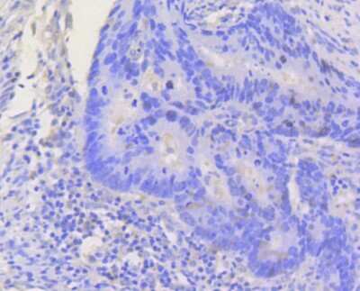 Immunohistochemistry-Paraffin: STAT3 Antibody (SY24-08) [NBP2-67432]