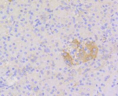 Immunohistochemistry-Paraffin: STAT3 Antibody (SY24-08) [NBP2-67432]