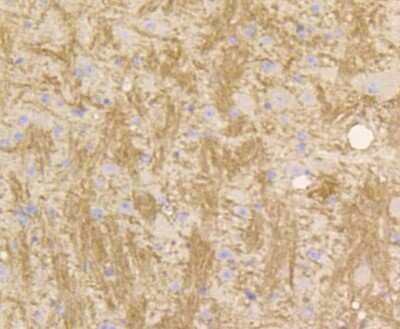 Immunohistochemistry-Paraffin: STAT3 Antibody (SY24-08) [NBP2-67432]